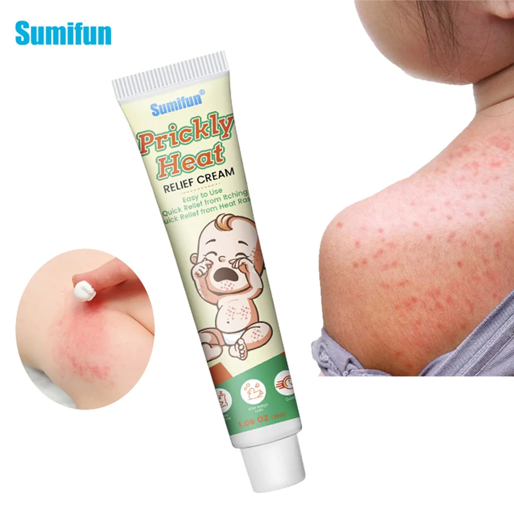 

30g Only$1.09 Sumifun Dispelling Prickly Heat Cream Relief Red Rash Antibacterial Ointment Mosquito Bites Baby Skin Care Plaster