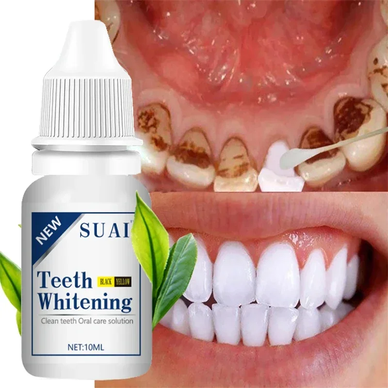 SUAI Teeth Whitening Essence Kit Dental Teeth Whitener Bleach Powder Oral Hygiene Dental Tools Remove Plaque Stains Fresh Breath