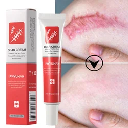 Fast Scar Removal Cream Effective Treatment Stretch Marks Burn Surgical Scars Acne Spots Repair Whitening Moisturizing Skin Care