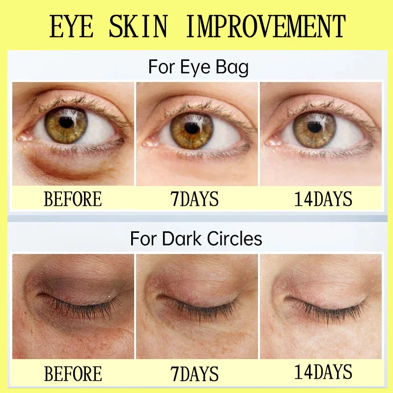 Lifting Eye Skin Cream Remove Eye Bags Smooth Fine Lines Firming Eraser Instant Eye Bag Lifting Gentle Nourish Tighten Eye Care