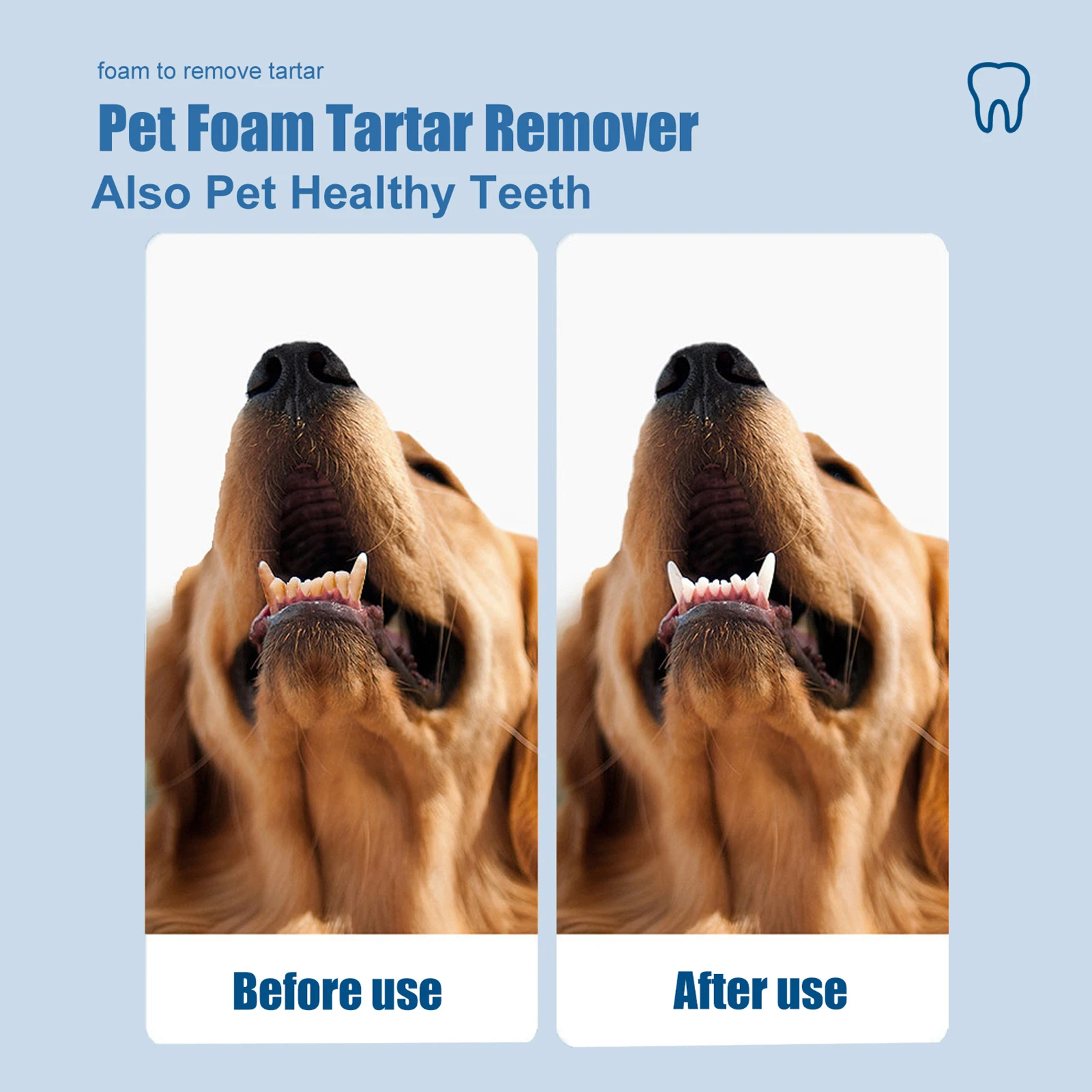 Schiuma per la Cura Orale degl - Teeth Whitening And Stain Removal recensione e prezzo