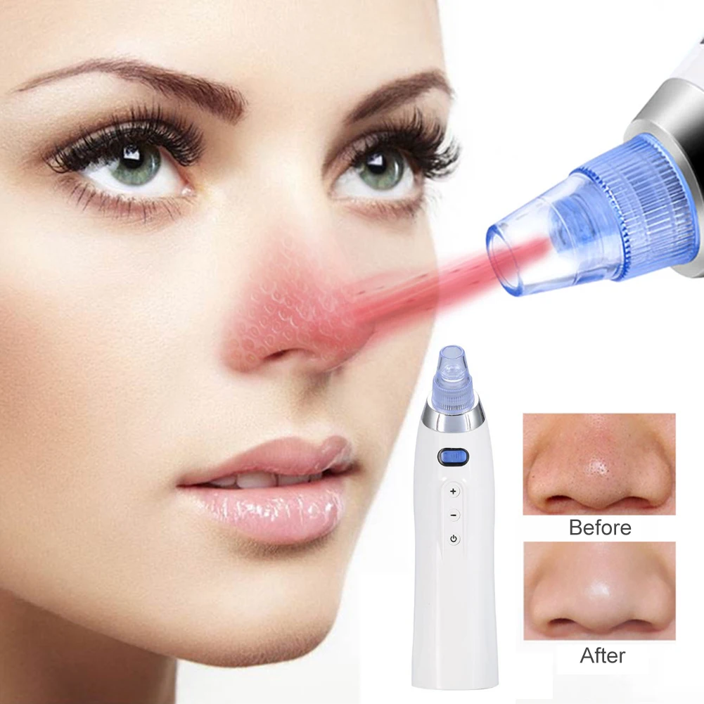 USB Electric Facial Blackhead Remover Vacuum Acne Cleaner Deep Pores Cleaning Machine Pimple Acne Removal Tool Skin Care