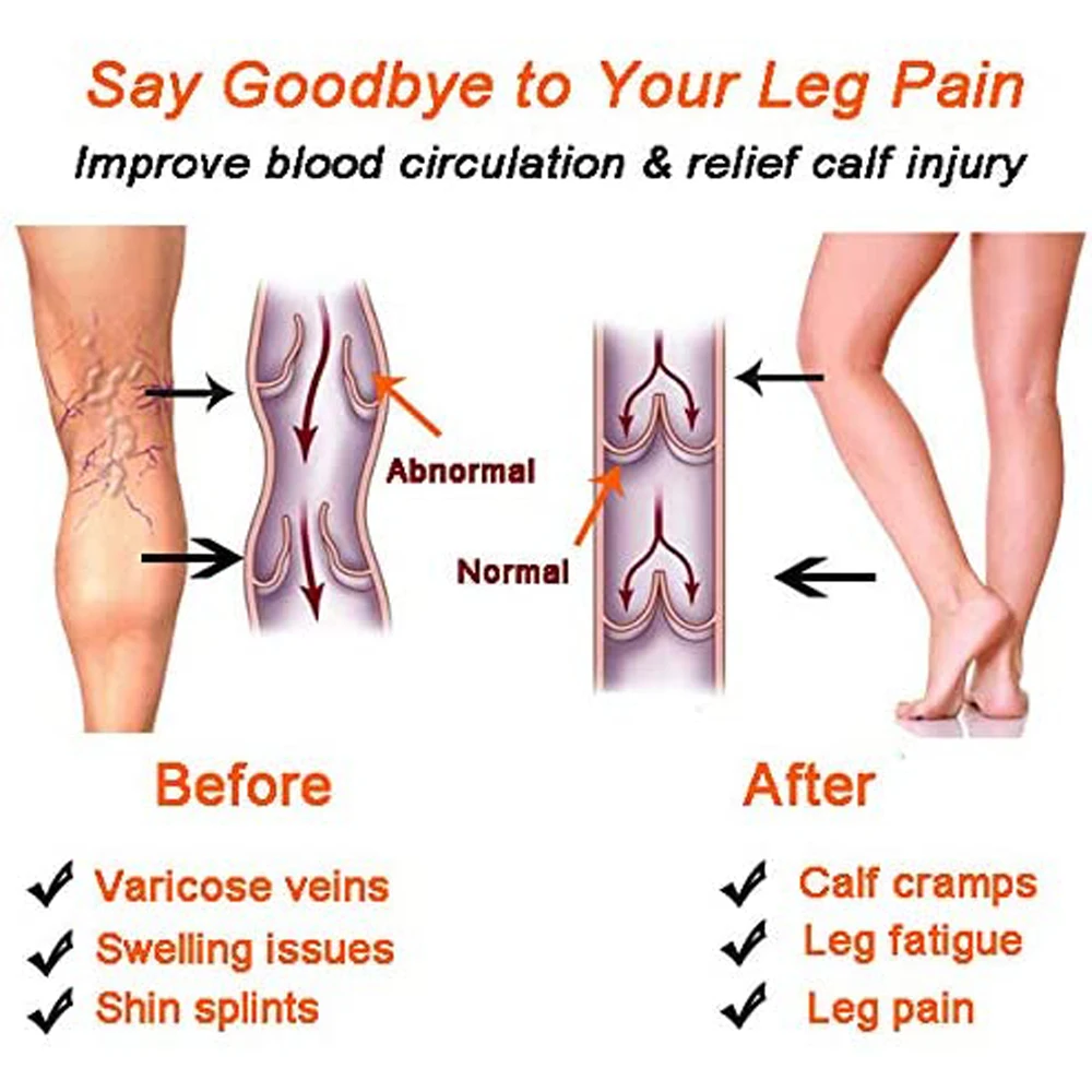 1 çift Buzağı sıkıştırma manşonu Bacak varis çorabı Buzağı ve Shin Desteği Şişme Shin Atelleri için Buzağı Ağrısını Rahatlatmak Varisli Damar