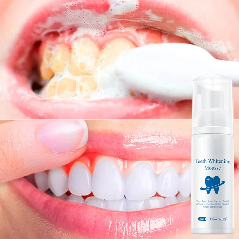 Teeth Whitening Mousse Tooth Whitening Cleaning White Teeth Oral Hygiene Toothpaste Bleaching Remove Stains Dental Tool