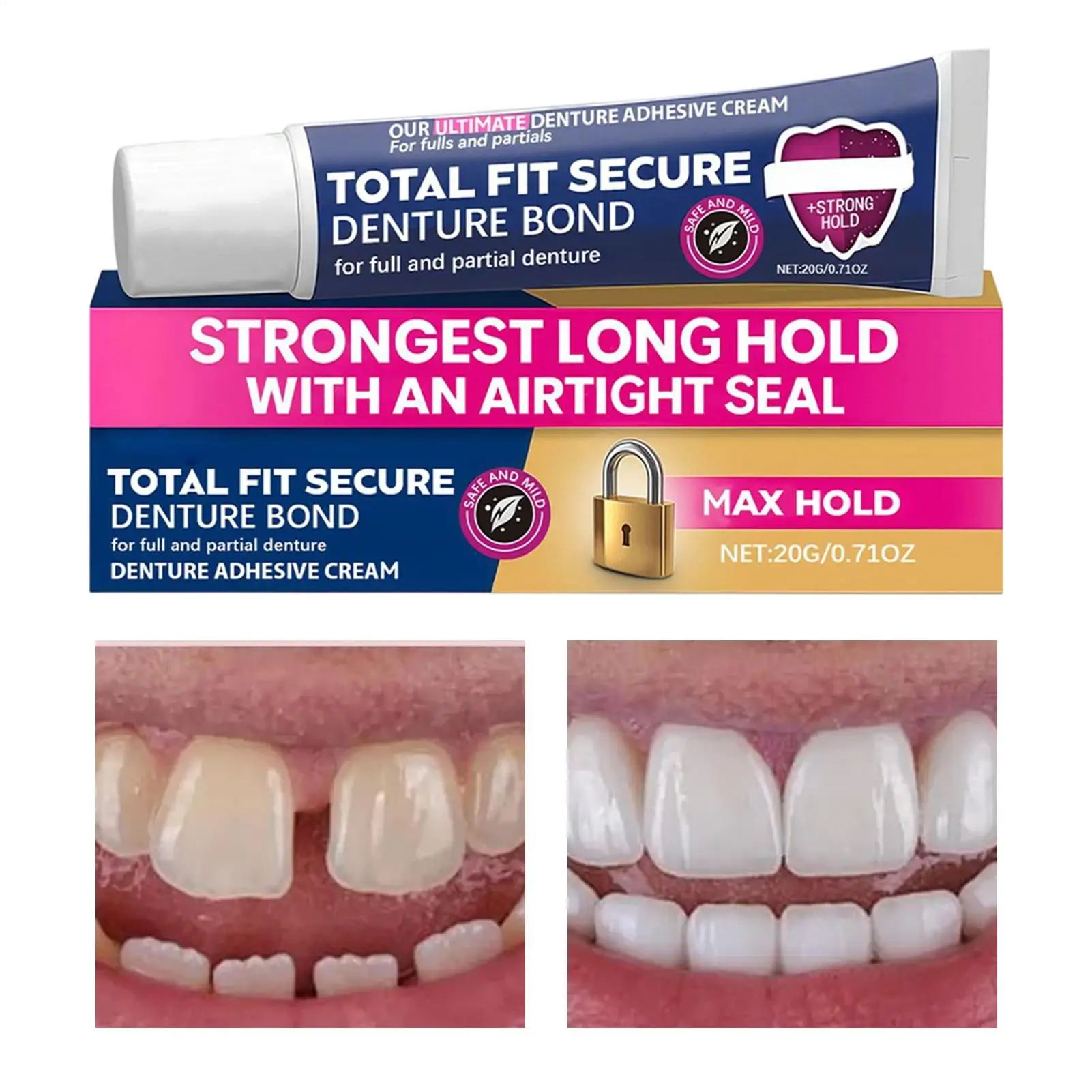 

Long-Lasting Tooth Glue Denture Glue For Teeth Long Hold Airtight Seal Comfort Partials Adhesive Strength Denture Wearers Glue