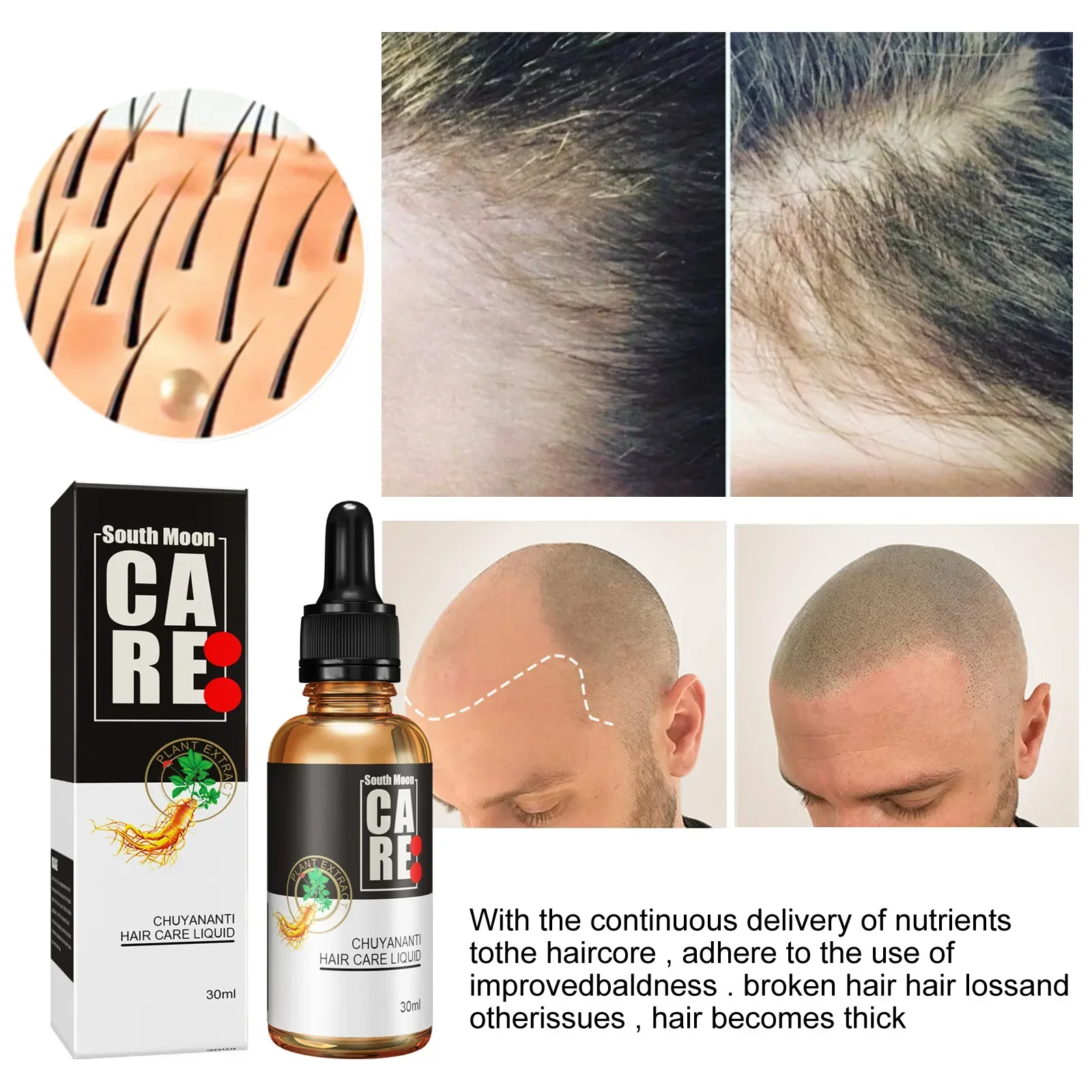 

Sdottor Anti hair loss and growth liquid for dense hair, anti hair loss and fixation, improving scalp oil and dandruff