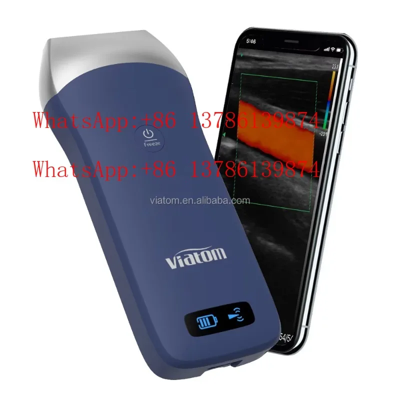 

7.5/10mhz Linear Probe Handheld Wireless Portable Scanner