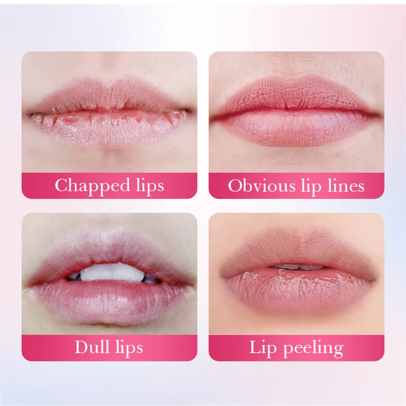 15 قطعة BIOAQUA كريستال الكولاجين قناع الشفاه ترطيب طبطب الشفاه أقنعة هلام تبييض ترطيب الشفاه سمنة الشفاه العناية بالبشرة