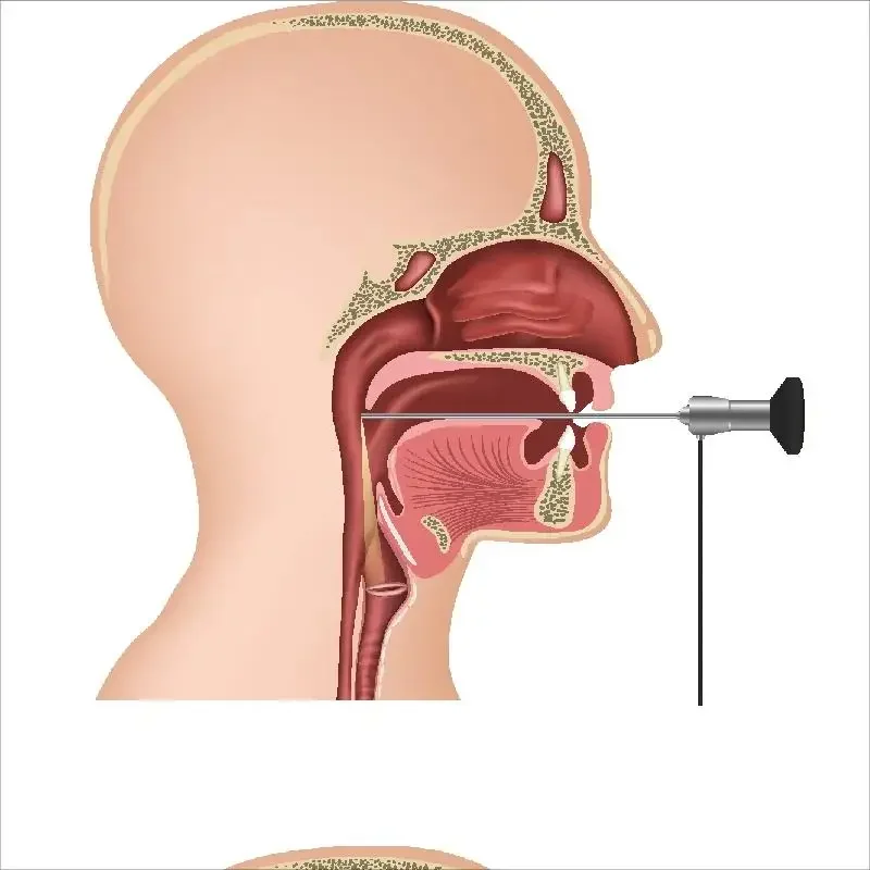 8mm laryngoscope rigid endoscope