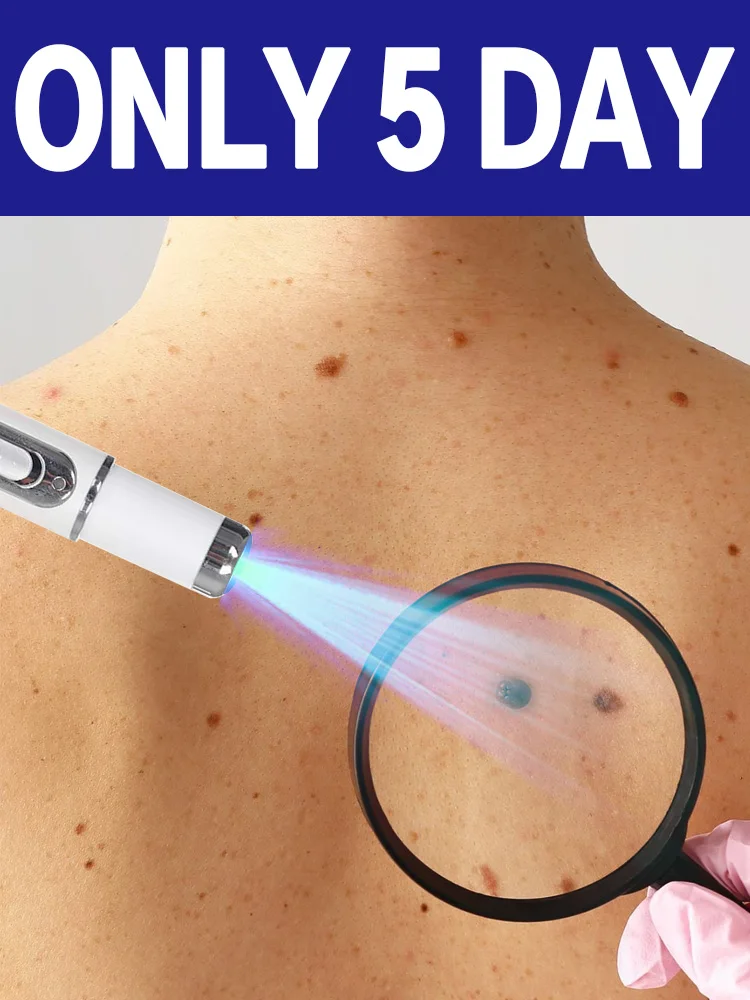 

Набор портативных ручек Generation1 с защитой от синего света, унисекс, специальное предложение, бесплатная доставка