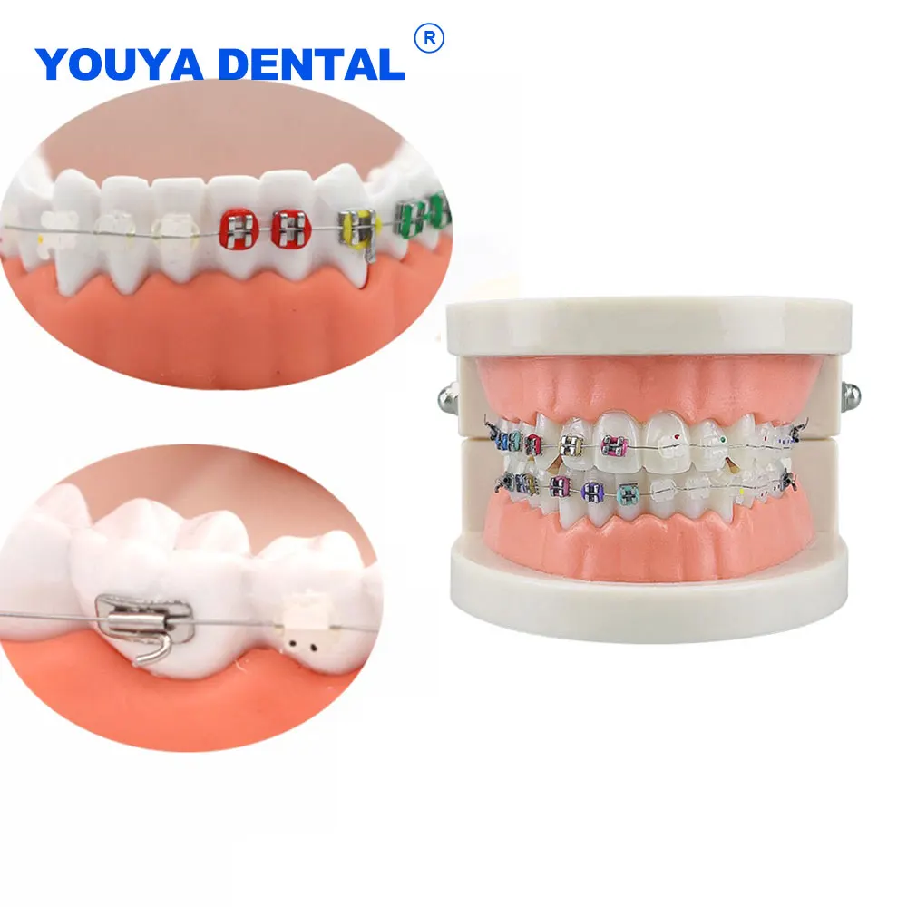 

Half Metal Half Ceramic Brackets Braces Dental Orthodontic Teeth Model Teaching Study Typodont Demonstration Dentist Equipment