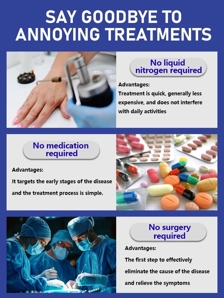 Bolígrafo unisex con luz azul: ¡consulte un furtivo en nuestra herramienta para el cuidado de verrugas! Lote limitado disponible.