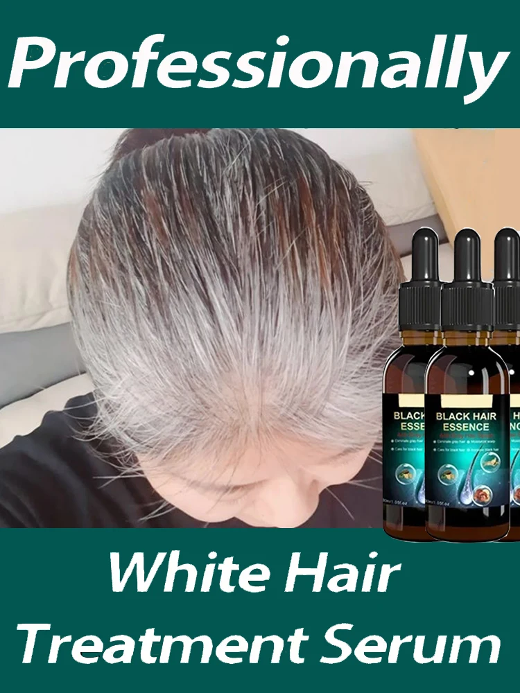 

Anti Gray Hair Serum Repair White & Darkening Natural White to black Hair Nourishing Hair Care Remedy