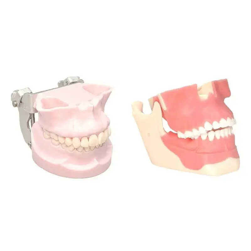 Dental Teeth Model Customized Anchorage Nail Training Teeth Model Dental Teaching Practice Teeth Model