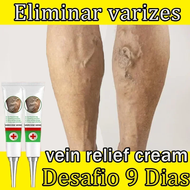 Varicose vein specific drug treatment leg swelling of earthworm blue veins raised official genuine special