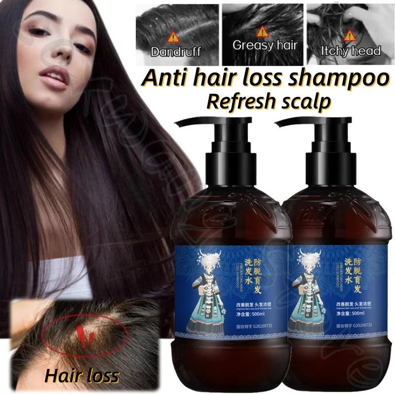 

Ginger nourishing shampoo 500ml, refreshing and fluffy, strengthens hair, soothes hair follicles and improves hair loss