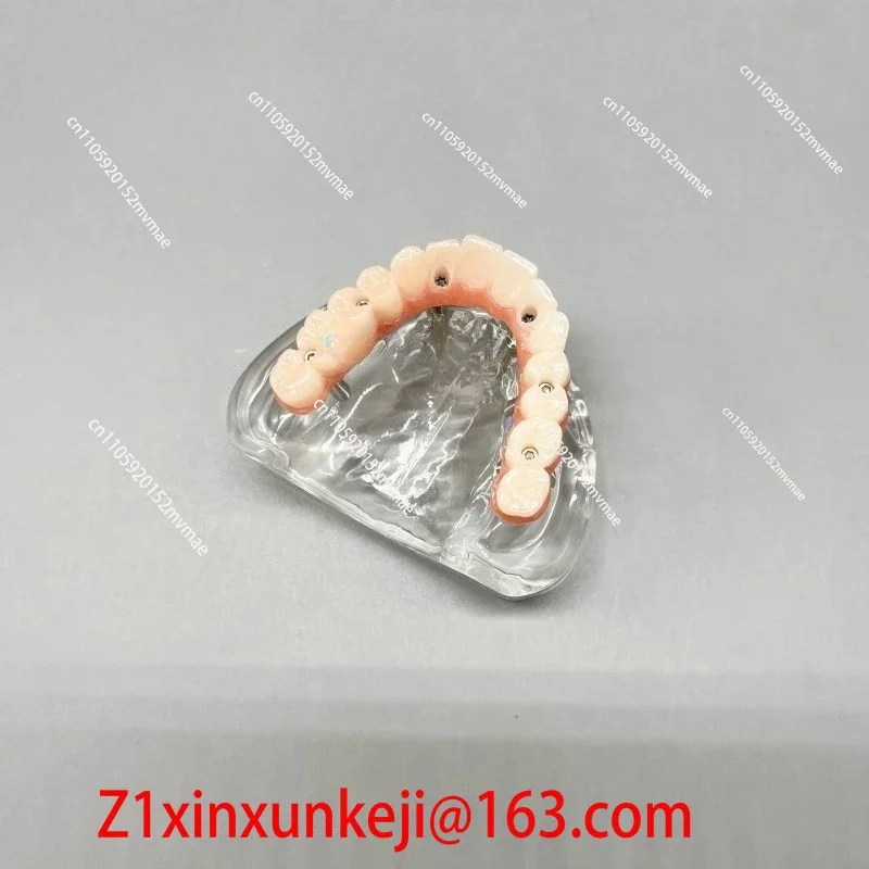 Oral Model Ma Long Bridge Denture Restoration Implant Dental Simulation Demonstration Simulation Teaching