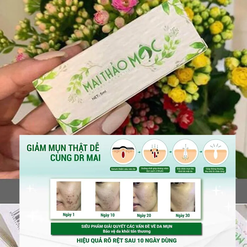 ماي ثيا خور دكتور ماي نوكواد 5 مل لعبة الخنزير المهام الشوك تشو دا نغلق كسه تشيسين هانغ، مزيل حب الشباب، البشرة الحساسة المناسبة