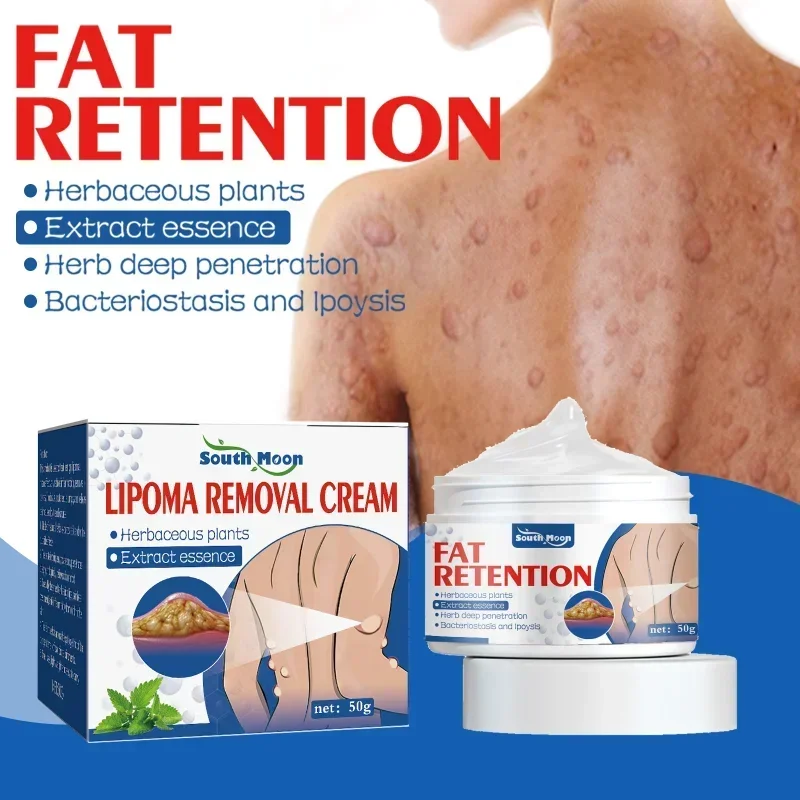 Lipoma Removal Cream Reduce Inflammation Treat Subcutaneous Lumps Relief Pain Anti Tumor Improve Fat Nodule Remove Skin Swelling