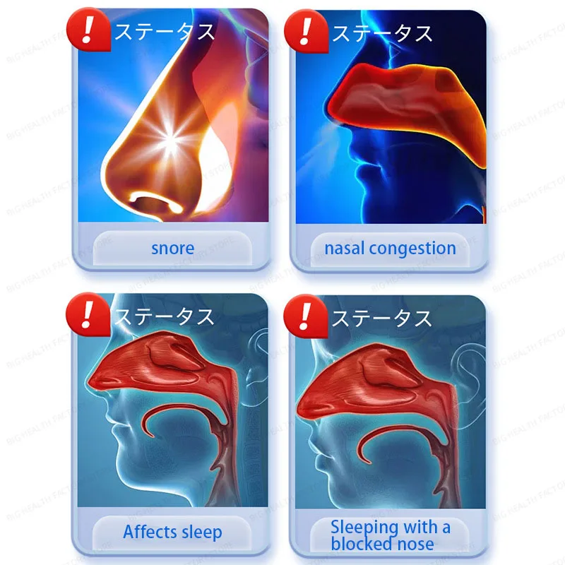 رقعة تهوية الشخير للنوم والشخير والنوم احتقان الأنف وانزعاج الأنف ورقعة الرعاية الصحية الخارجية