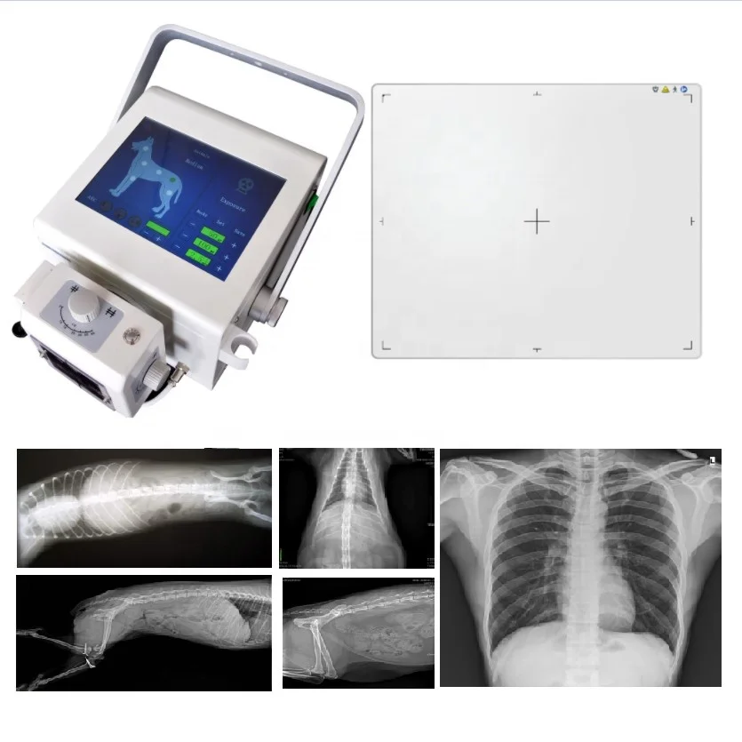 X- Ray Digital Portable X-Ray Machine With DR Panel For Radiography Imaging Diagnosis Digit Xray Detector