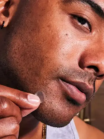 36 unidades de remendos calmantes para acne - tecnologia hidrocolóide curam suavemente imperfeizes, proteção invisível.