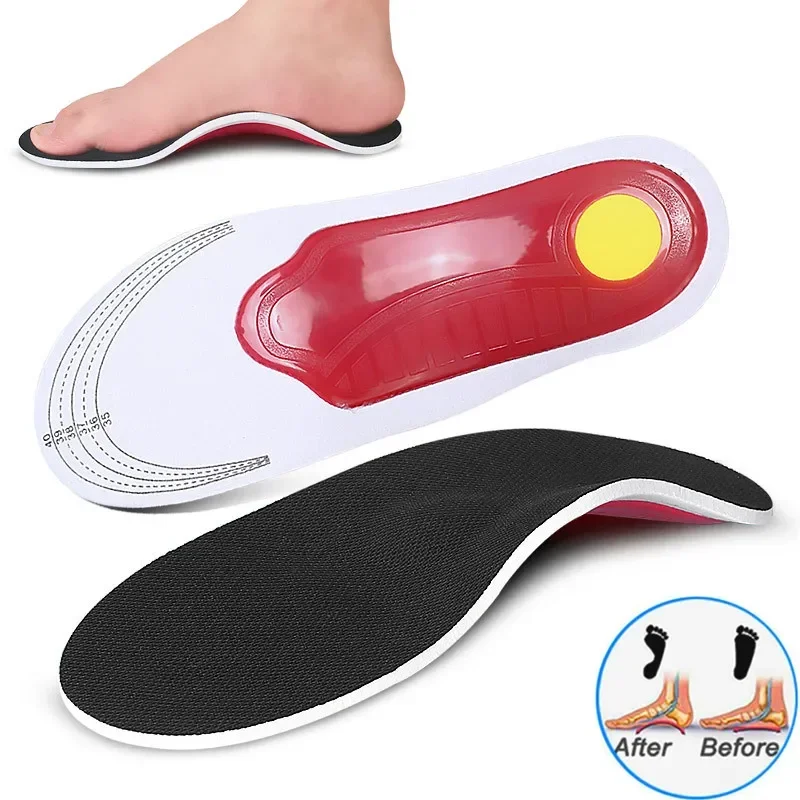 Orthopedic Insoles Arch Support Flatfoot Shoe Insole Sports Inserts Foot Cushion Heel Pads for Men Women Foot X/O Leg Correction