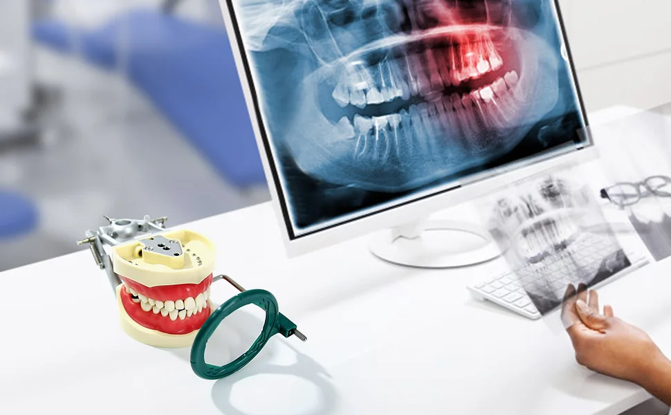 

Generic X-Ray Film Positioning System Locator Instrument Dental X-Ray Film Holder Oral Care Tool Set FPS 3000 Multicolor