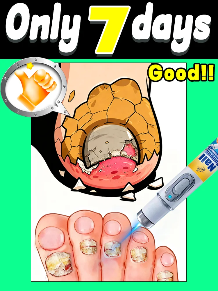 Verabschieden Sie sich von Nagelpilzinfektionen! Dank modernster antimikrobieller Penetrationstechnologie erhalten Ihre Nägel einen revitalisierten, natürlichen Glanz.