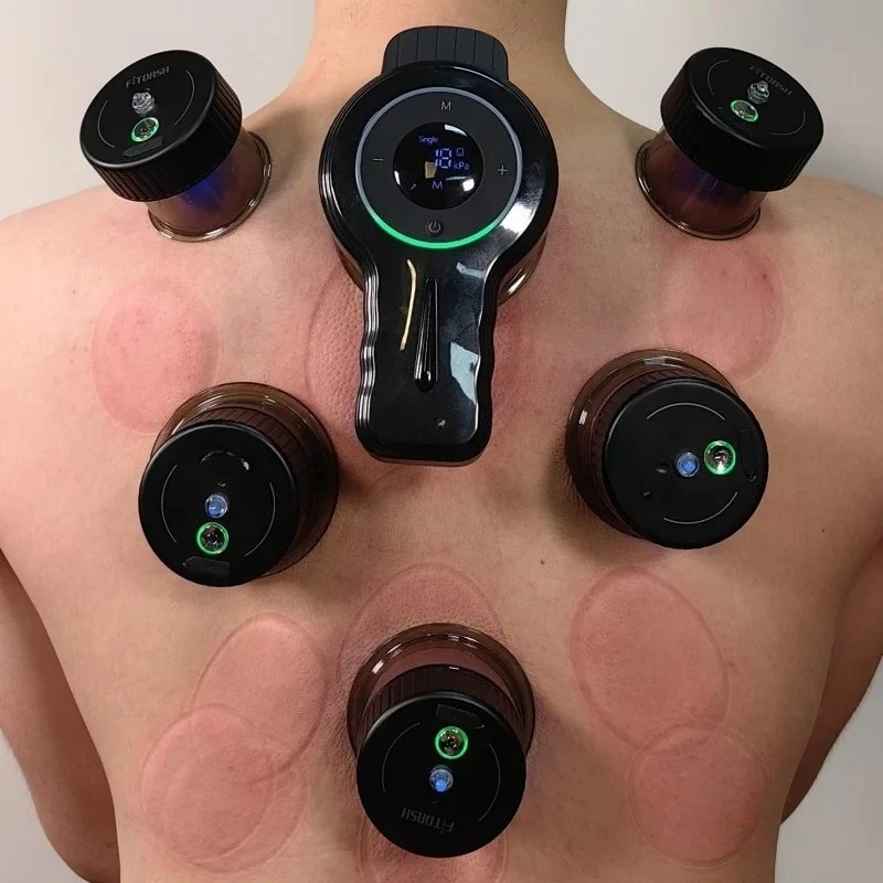 Fitdash Rechargeable Smart Cupping Cups Therapy Massager Red Light Cupping Set Vacuum Cupping Therapy Equipment