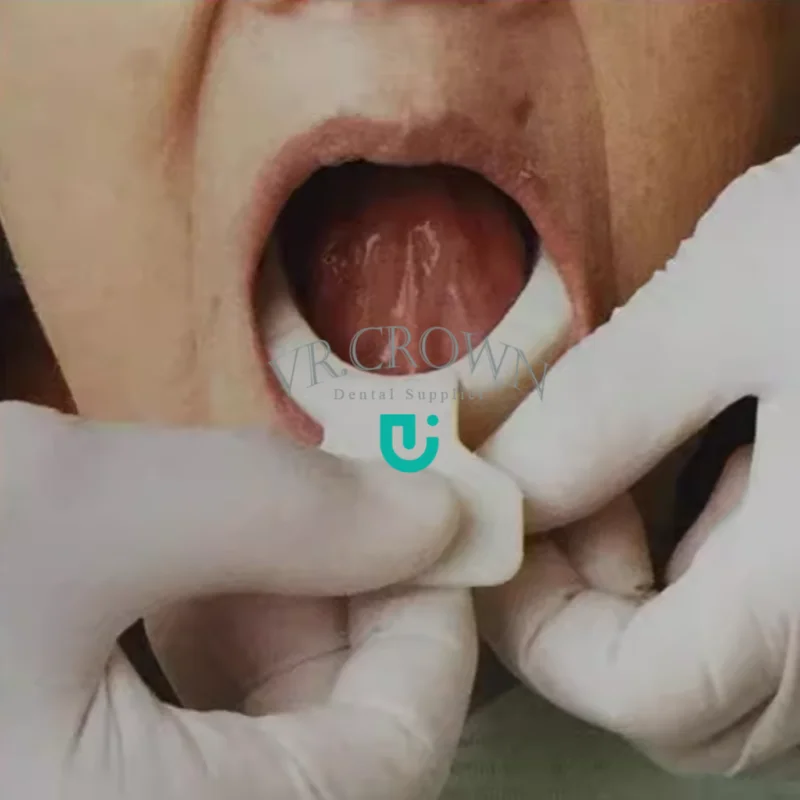 Dental Frame Cut Back FCB Impression Trays Mandibular Denture Edentulous 6pcs  FCB Trays IVOC DENT