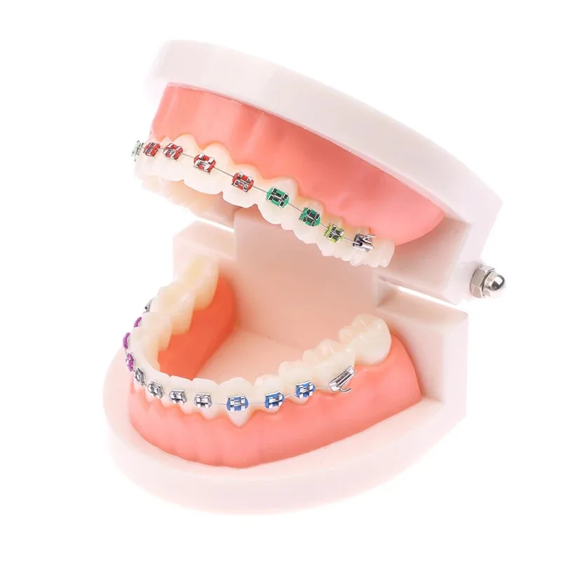 1Pc Orthodontic Dental Treatment Model Teaching Study Typodont Teeth Model With Metal/Ceramic Brackets Arch Wire Ligature Ties