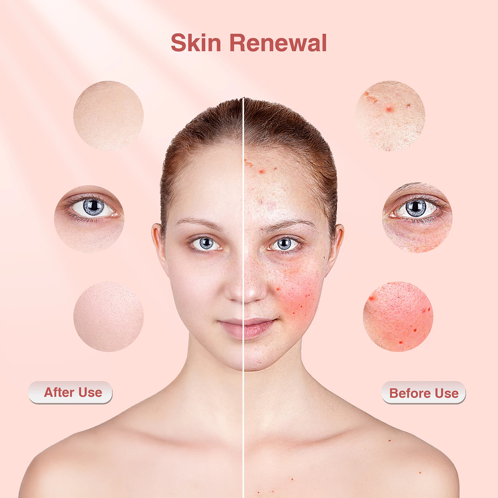 Red Light Therapy Photon Mask Hello Face M500S LED 630nm 850nm Near-Infrared Light Therapy Facial Mask Professional Beauty Care