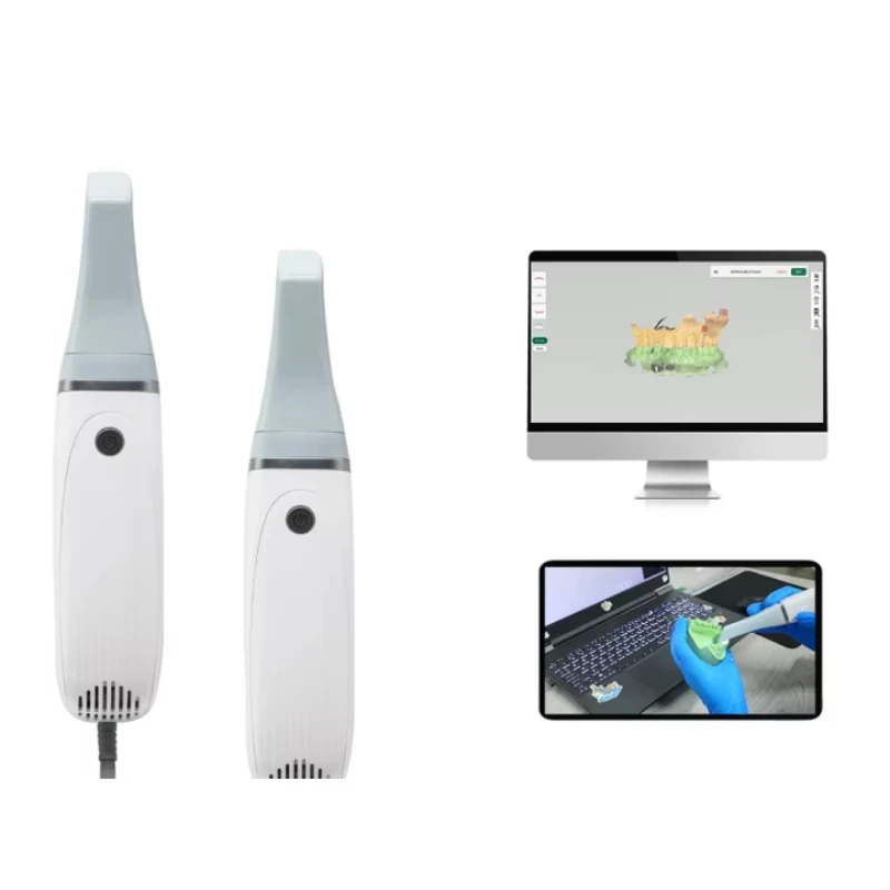 Intraoral Scanner F… - image