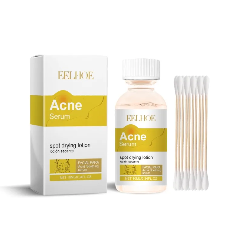 Acne Gezicht Serum Puistje Scaring Marks Zacht Verwijderen Olie Controle Gevoelige Huid Hydraterende Helderder Gezichtsserum Zachte Huidverzorging