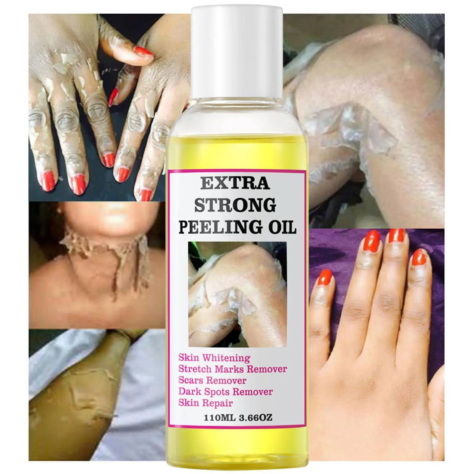 Óleo de Peeling para Pele Escura, Super Força, Amarelo, Forte, Clareamento, Hidratante, Remove De S8B0