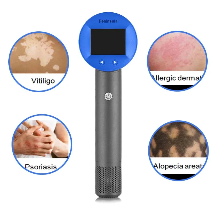 Peninsula Medical Phototherapy LED 308nm Pototherapy Device Vitiligo UVB Lamp