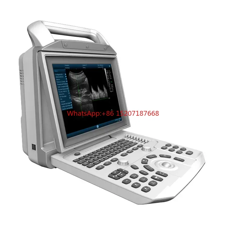 Medical Ultrasound Instruments Black And White Trolley Hospital Ultrasound Diagnosis System Medical Ultrasound Scanner