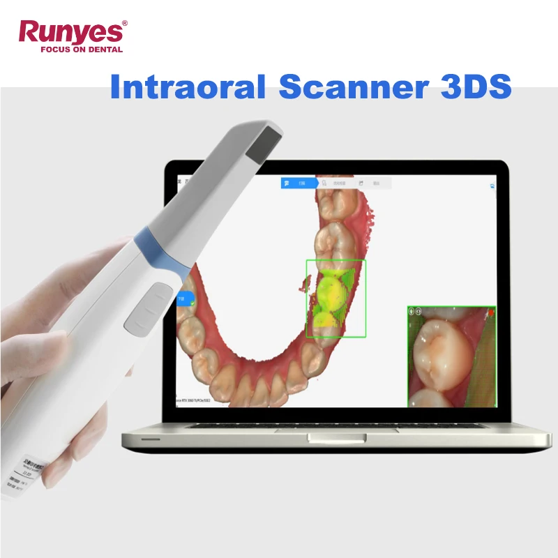 Runyes 3DS Intraoral Scanner Dental Digital 3D Imaging Intraoral Scanner Orthodontic Treatment Digital Impression Intra oral