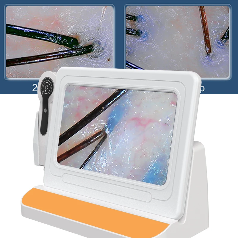 Scalp Hair Follicle Detection 10 Inch Screen 1000W HD Camera Hair Loss Dandruff Scalp Inflammation Follicle Blockage Testing