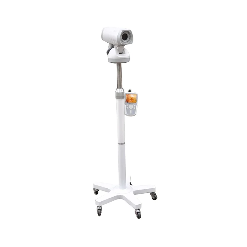 High Accuracy Led Video Colposcope Digital Portable Colposcope With Tripod Hospital Gynecology Inspection Video Colposcope