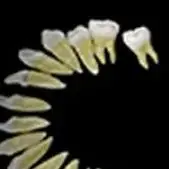 

Dental Model Standard Teaching Typodont Soft Gum Teeth Model Training Teeth Jaw Models 28 Removable Teeth Dentistry Lab Model