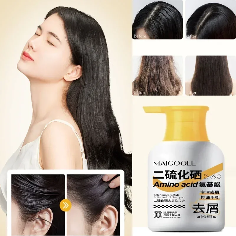 400ml Selenium Disulfide Dandruff Shampoo Anti-Dandruff Itching Anti-hair Loss Oil Control Nourishing Refreshing Shampoo