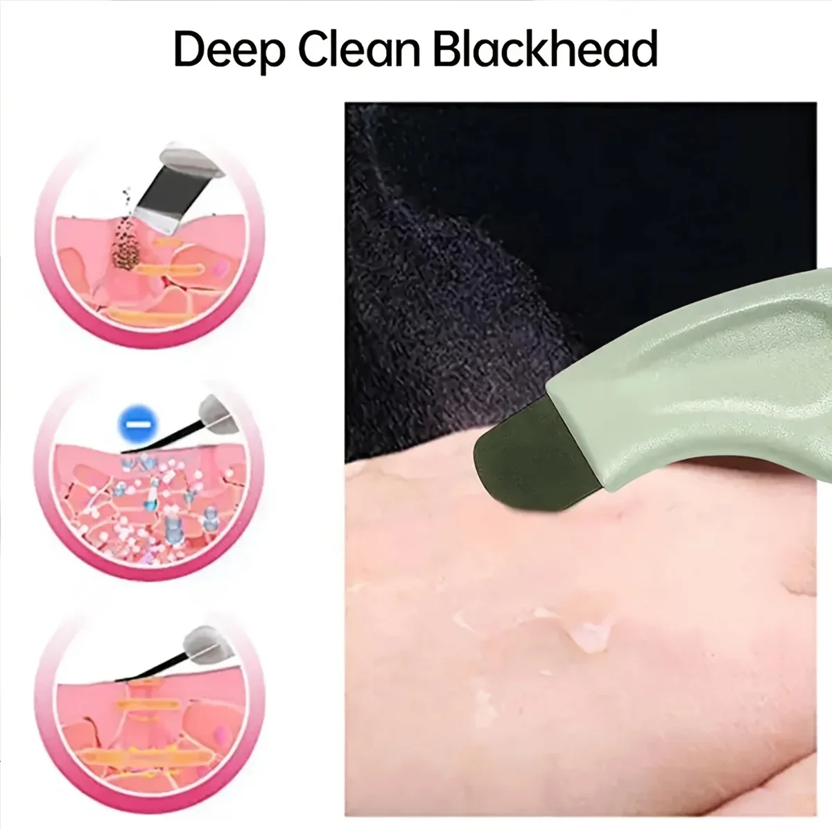 Facial Blackhead Removal Tool Nose Deep Cleansing Remove Whitehead Acne Handheld Beauty Care Tool