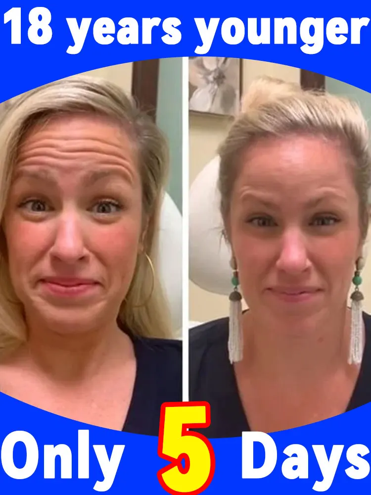 

Свет богини стирают морщины в просто 5 дней