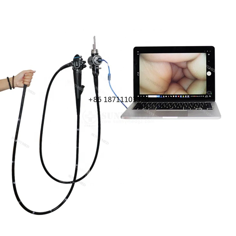 SY-PG045 Medical Trolley Video Endoscope Gastroscope Vet Endoscopic Imaging System Gastroscope Pet Hospital Endoscopy Machine