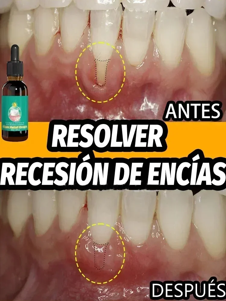 Restore gums