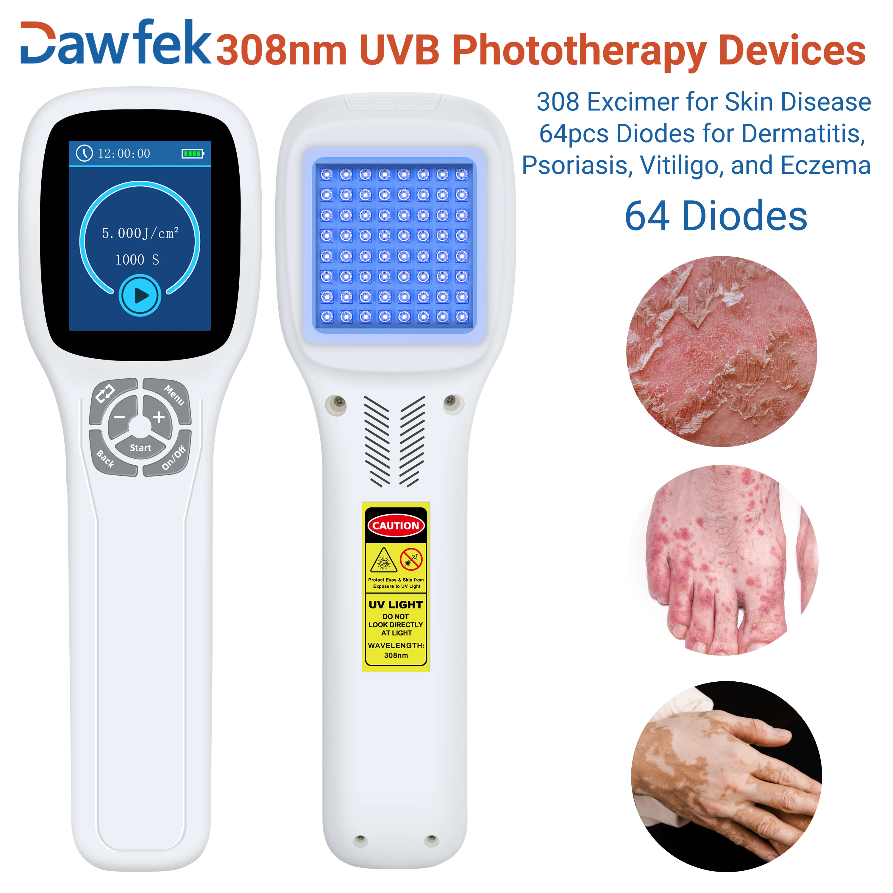 Dawfek Phototherapy Light For Vitiligo Psoriasis 308Nm*64 Diodes For Hospitals, Clinics And Homes