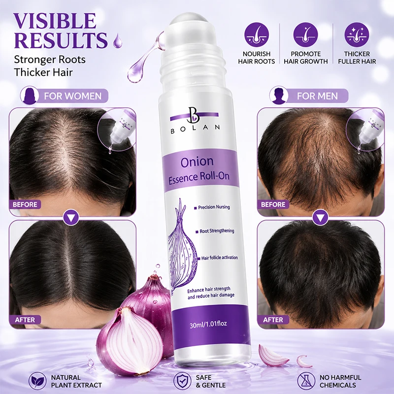 Onion Hair Growth Roller Essence Nourishes Scalp Helps Reduce Hair Breakage  calp Massage Serum Fuller Hair for Women and Men