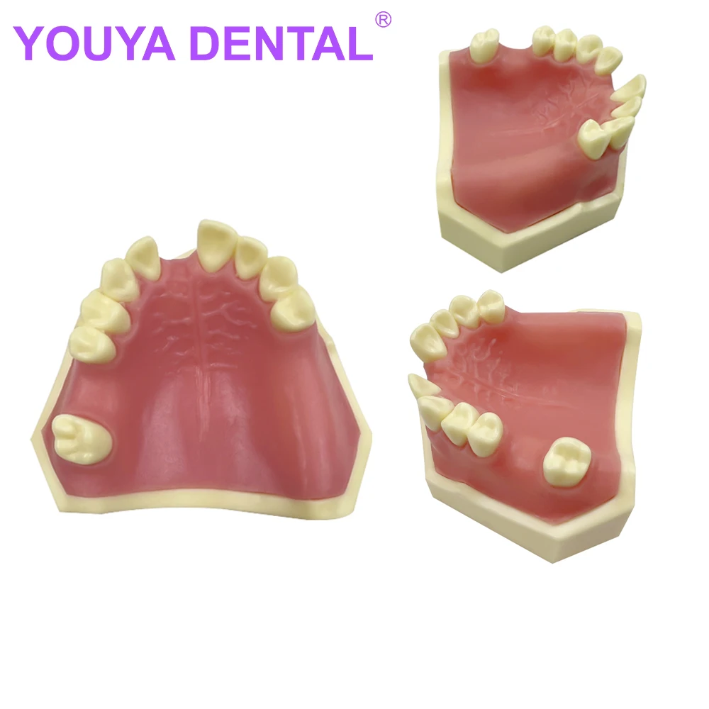 

Dental Implant Model For Practice Demo Typodont Teeth Soft Gum Jaw Model Dentist Teaching Training Demonstration Tools Product